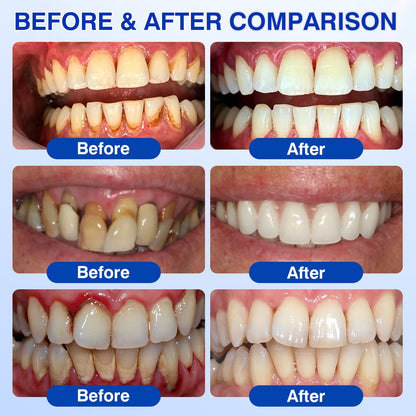 IE🏅🦷🛡️Natravor® GumRevive Periodontal Repair Gel