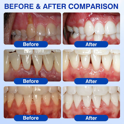 IE🏅🦷🛡️Natravor® GumRevive Periodontal Repair Gel