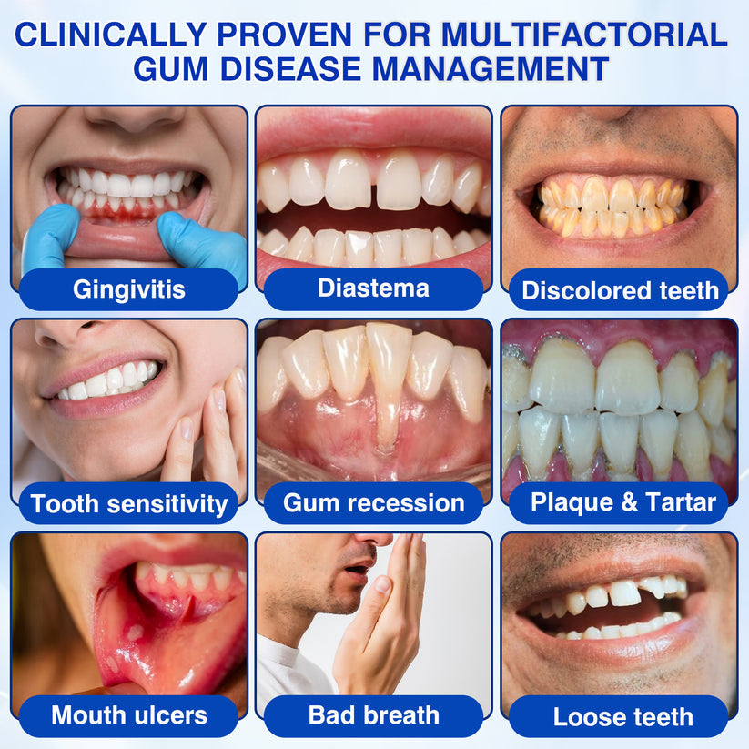 IE🏅🦷🛡️Natravor® GumRevive Periodontal Repair Gel