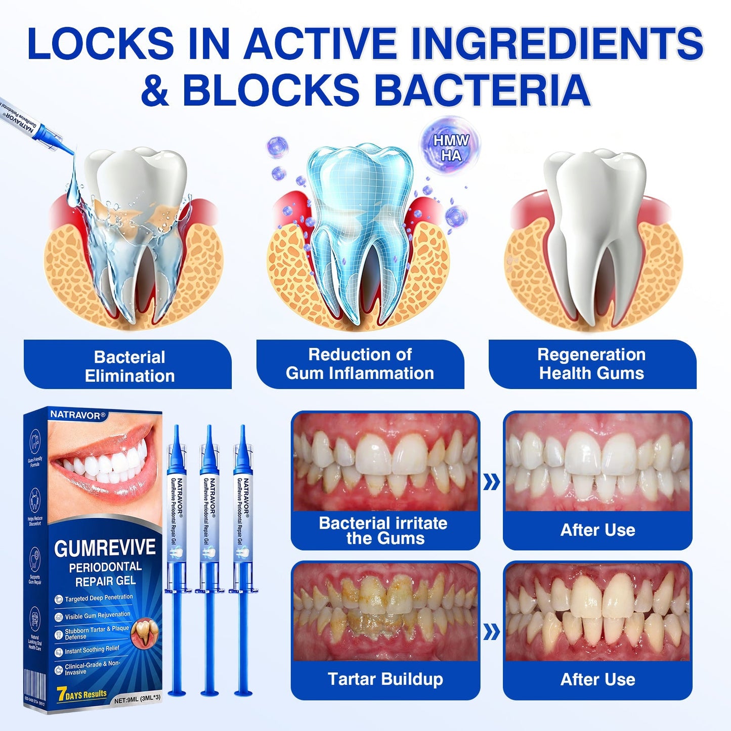 IE🏅🦷🛡️Natravor® GumRevive Periodontal Repair Gel