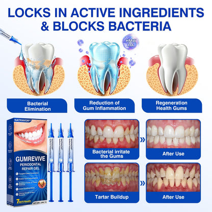 IE🏅🦷🛡️Natravor® GumRevive Periodontal Repair Gel